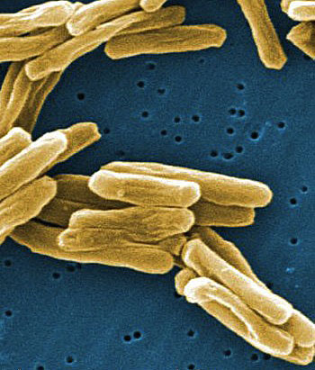 Some 60 people in Nunavik are receiving treatment for latent tuberculosis which shows they have been infected with the TB bacteria, shown here. (FILE IMAGE)
