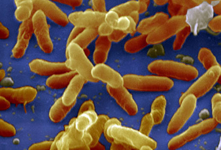 An illustration of the bacteria that causes whooping cough, a respiratory infection that spread to anyone, although the most severe cases are seen in children under the age of two. With help from Health Canada, the Government of Nunavut will conduct vaccination clinics in Clyde River, Pond Inlet and Pangnirtung this week. (IMAGE COURTESY OF WEBMD) 