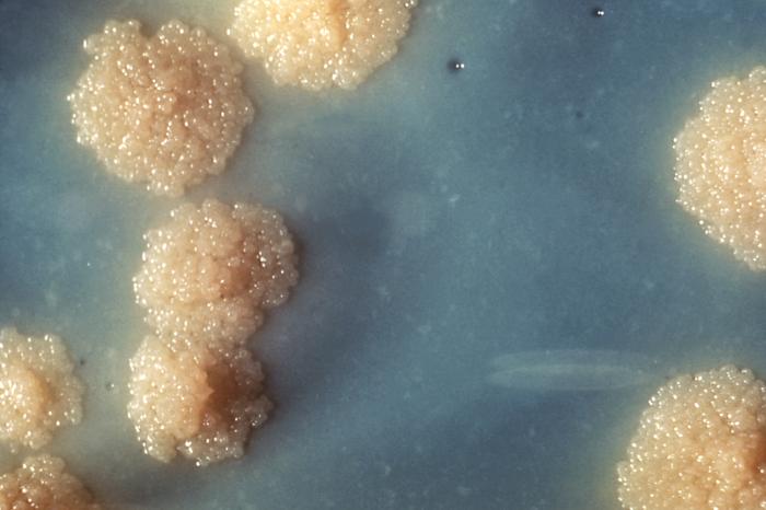 This is a close-up of a Mycobacterium tuberculosis culture, showing the bacteria that lead to TB, which infected Nunavummiut in 2016 at a rate nearly 180 times greater than among non-Indigenous Canadian residents. (PHOTO COURTESY OF THE CENTRE FOR DISEASE CONTROL/ DR. GEORGE KUBIC)
